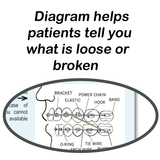 Preventing Problems With Braces