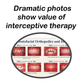 Interceptive Referral Aid