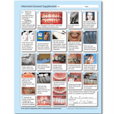 Informed Consent Supplement