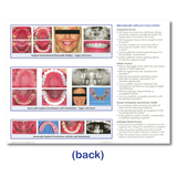 Implant Referral Aid