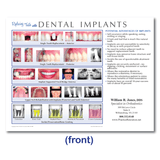 Implant Referral Aid