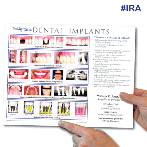 Implant Referral Aid