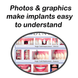 Implant Referral Aid