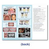 Preliminary Dental Implant Evaluation