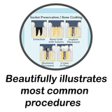 Preliminary Dental Implant Evaluation