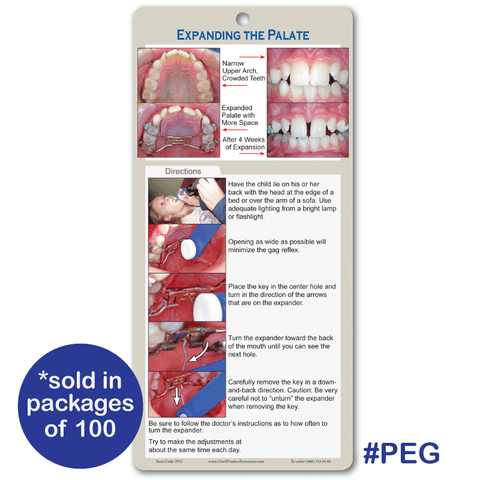 Palatal Expander Guide