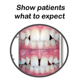 Palatal Expander Guide