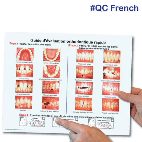 Orthodontic Quick Check In French