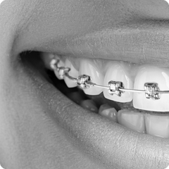 Products for Orthodontics