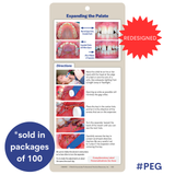 Palatal Expander Guide