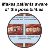 Esthetic Dentistry Summary